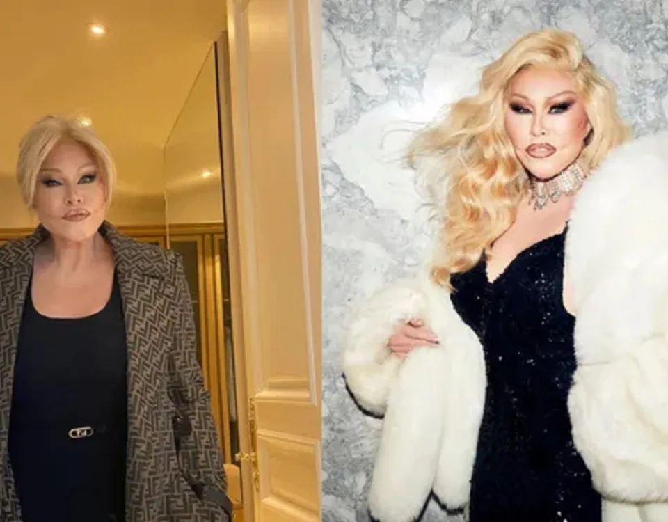 Morta la 'donna gatto' Jocelyn Wildenstein