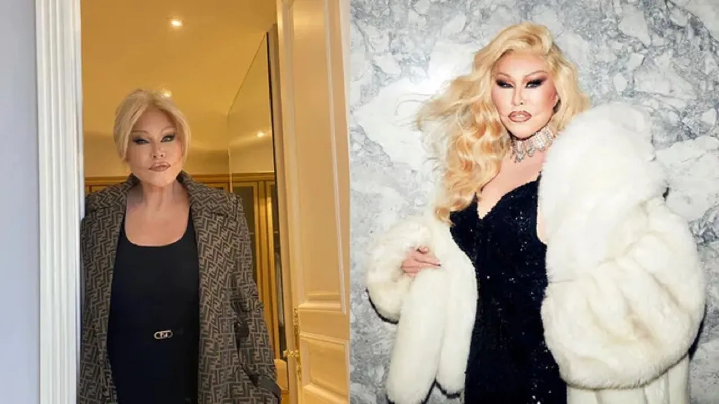 Morta la 'donna gatto' Jocelyn Wildenstein